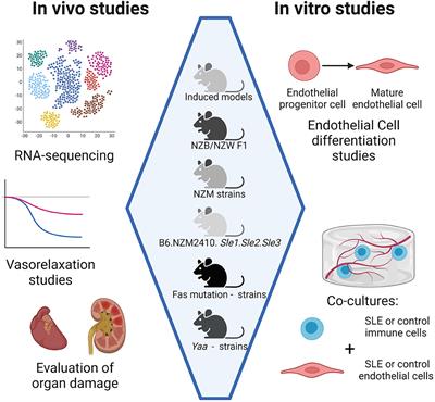 Vascular Inflammation in Mouse Models of Systemic Lupus Erythematosus